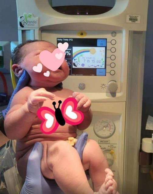 RSMC 代孕成功案例：7磅15安士健康宝宝诞生！